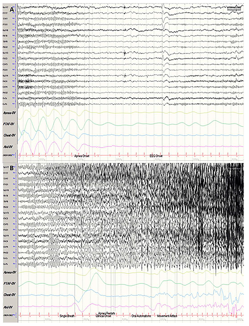 Figure 2: