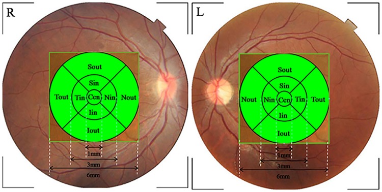 Fig 1