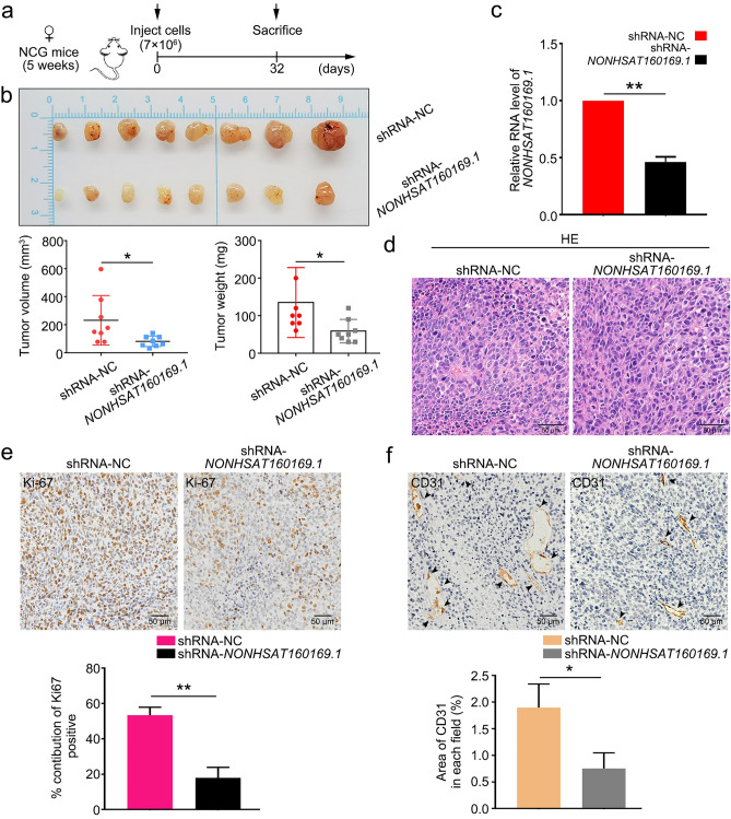 Long noncoding RNA NONHSAT160169.1 promotes resistance via hsa-let-7c ...