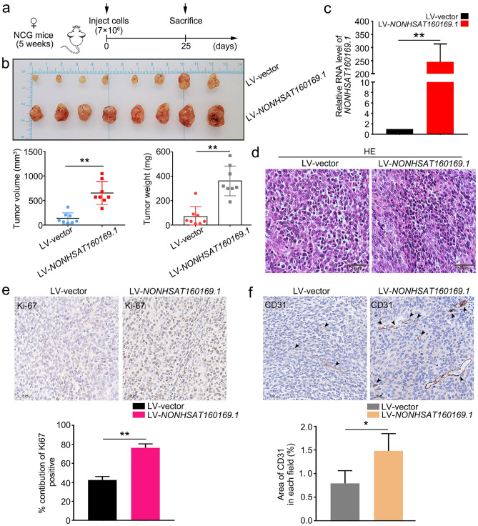 Long noncoding RNA NONHSAT160169.1 promotes resistance via hsa-let-7c ...