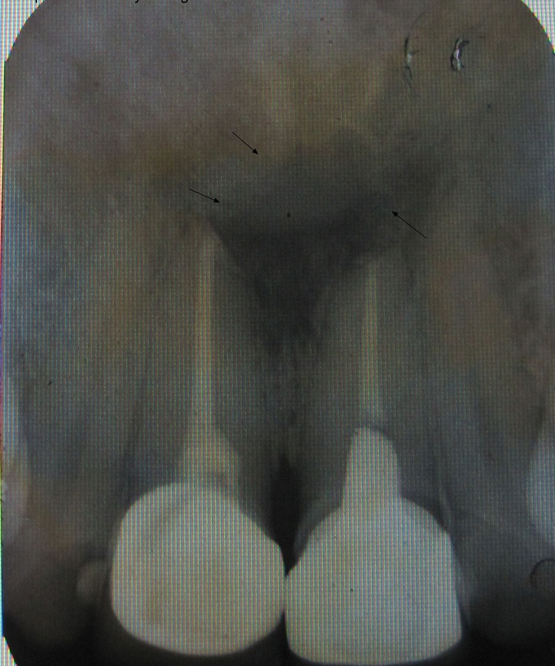 Figure 3