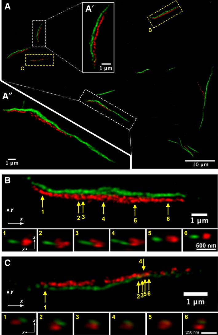 Figure 11