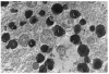 Fig. 16