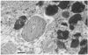 Fig. 15