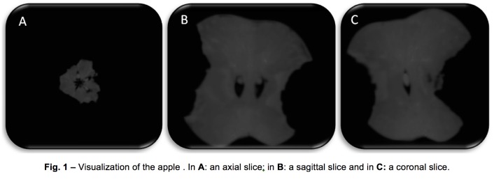 Fig. 1