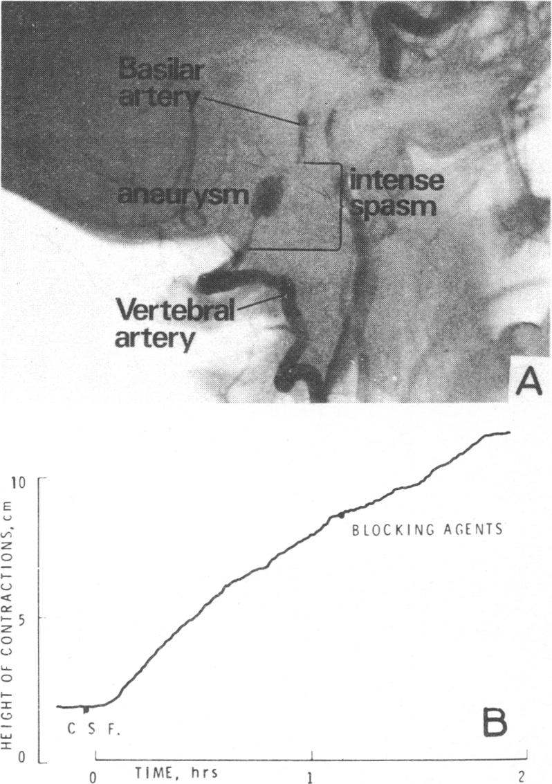 Fig 5