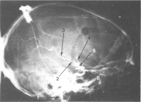 Fig 23