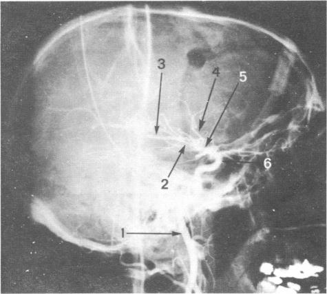 Fig 25