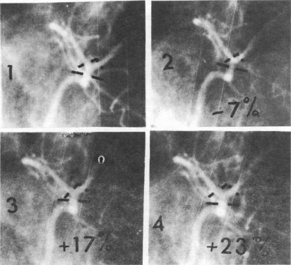 Fig 20