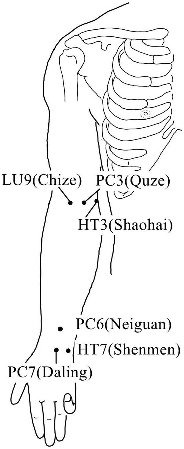 Application and underlying mechanism of acupuncture for the nerve ...