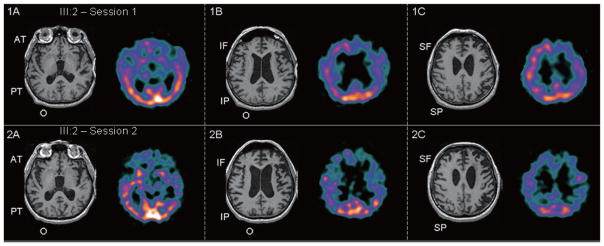 Fig. 1–2