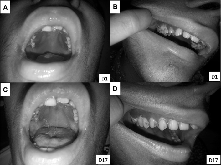 Fig. 1