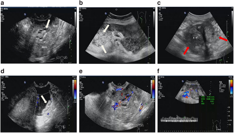 FIG. 1.