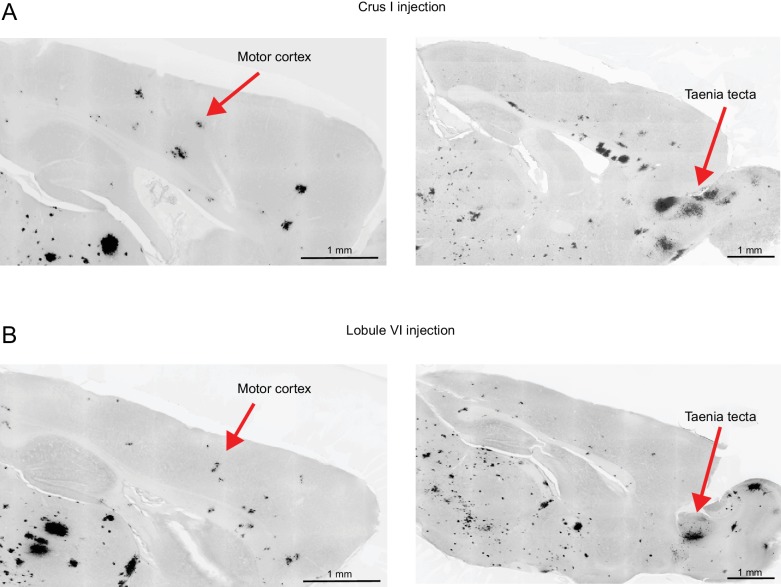 Figure 11—figure supplement 1.