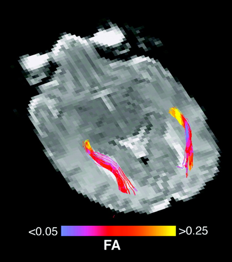 Fig 2.