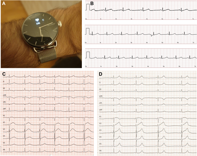 Figure 1