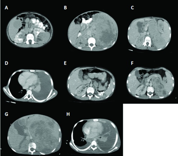 Fig .2.