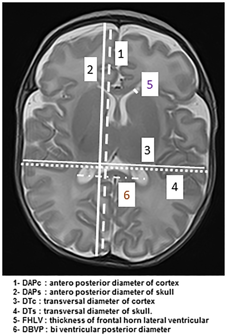 Fig 1