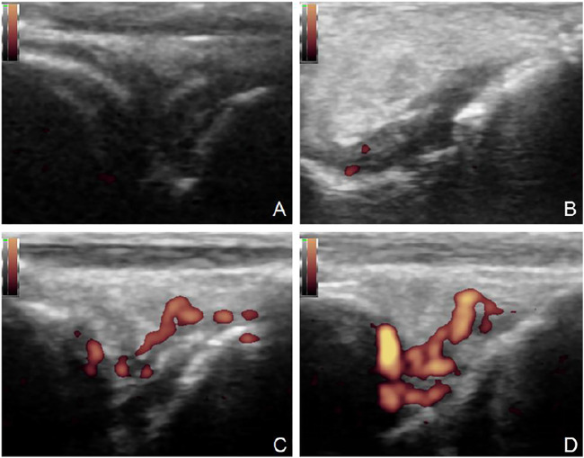 FIGURE 6