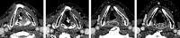 FIG 3.