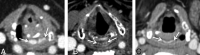 FIG 5.