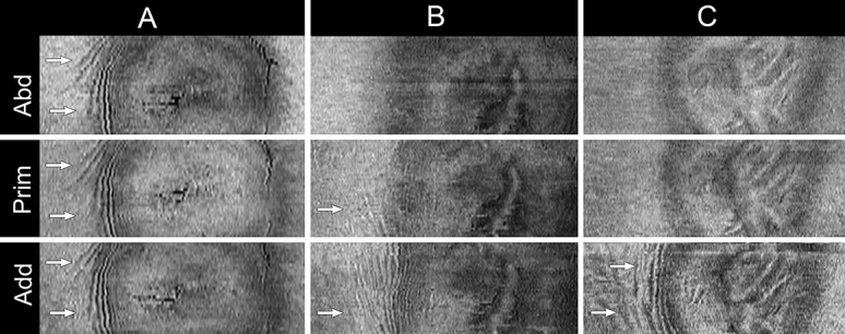 FIG. 15.