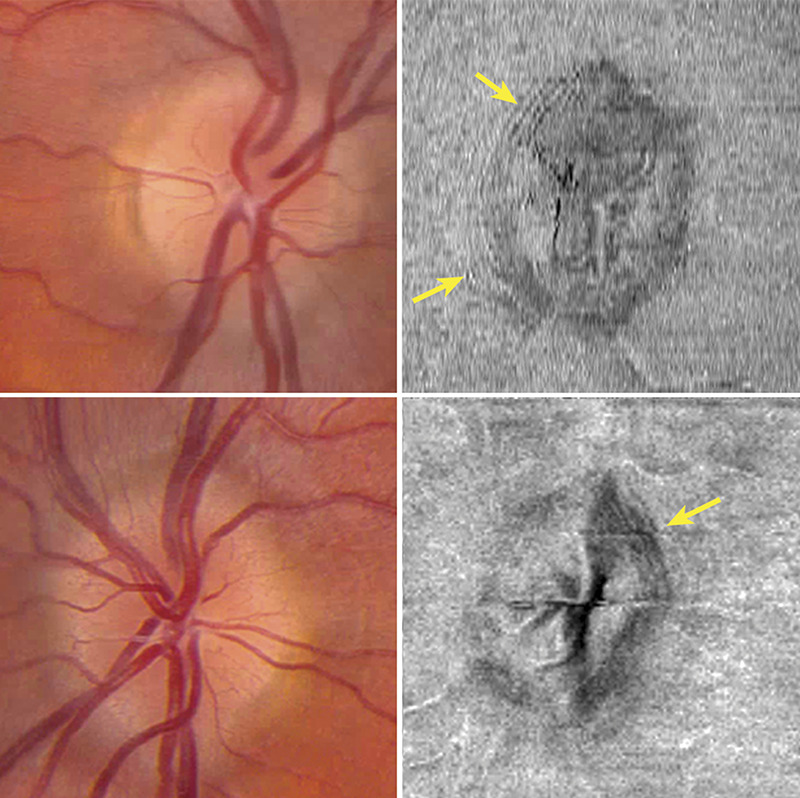 FIG. 11.