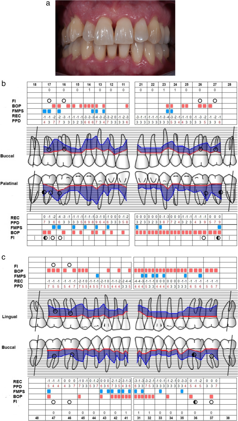 Fig. 2