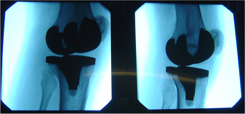 Fig.2