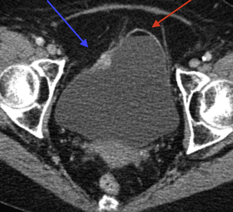 Fig. 4