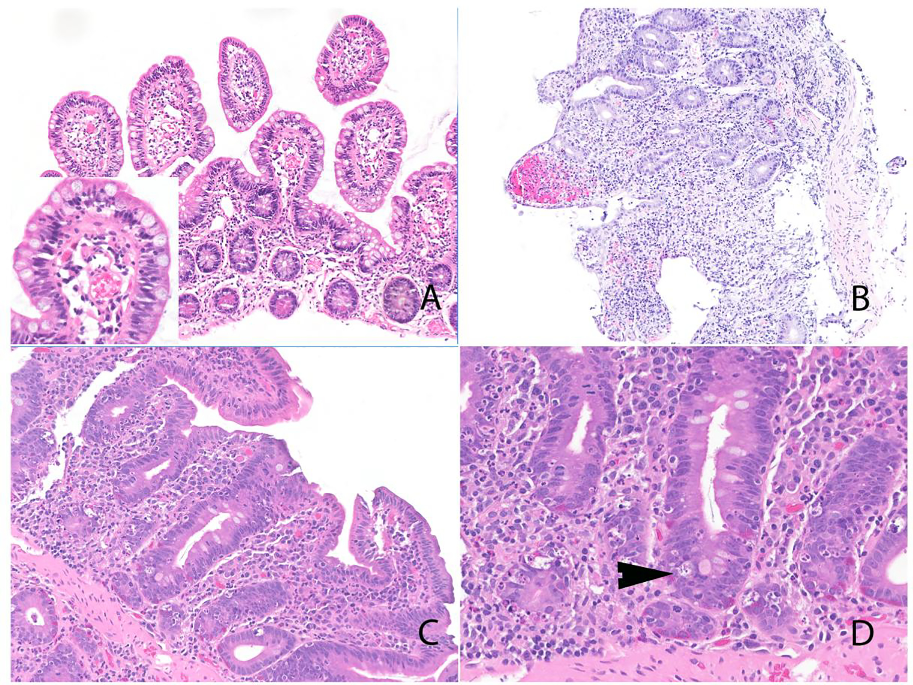 Figure 2: