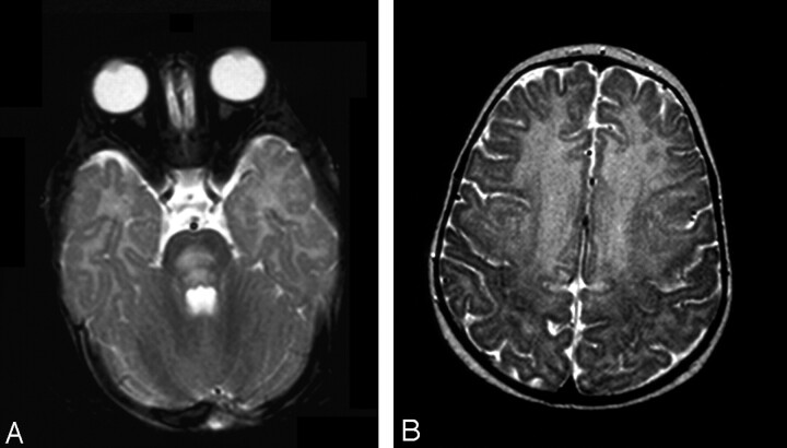 Fig 2.