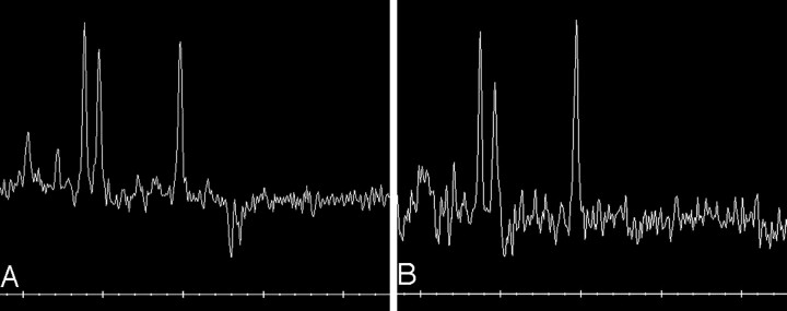 Fig 5.