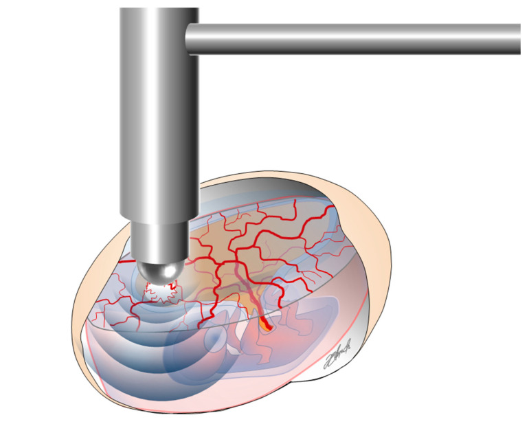 Figure 13