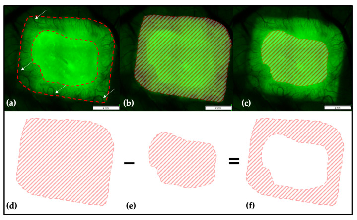 Figure 14