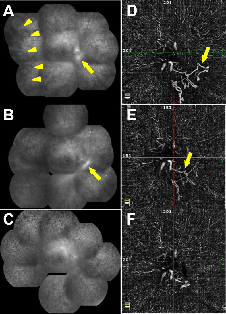 Fig. 3