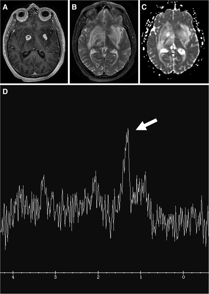 Fig. 10