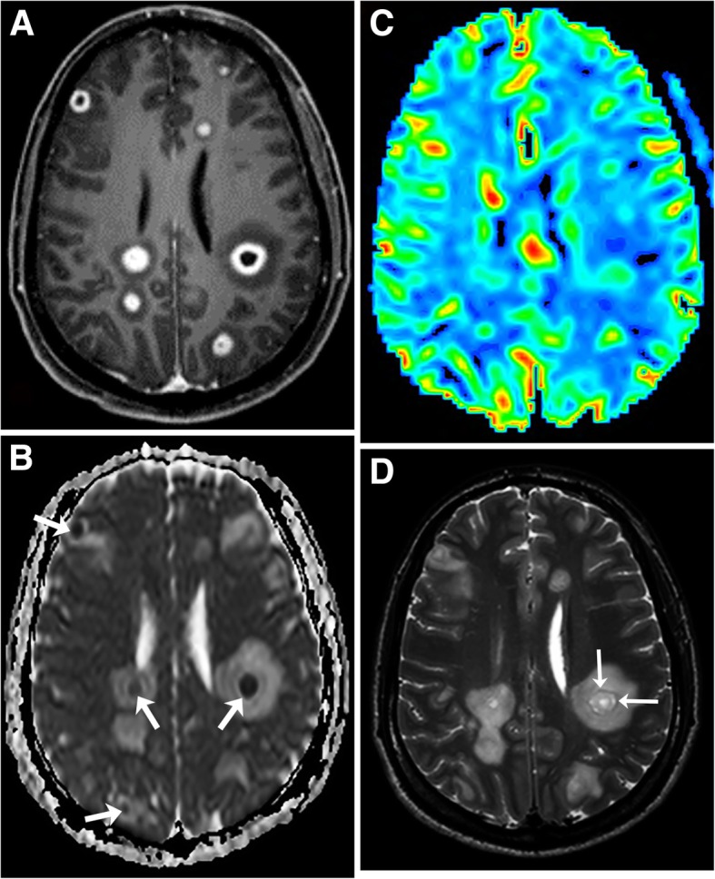 Fig. 9