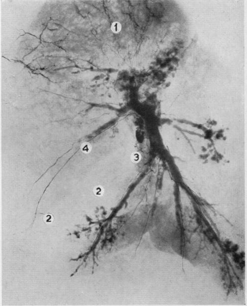 graphic file with name thorax00024-0008-b.jpg