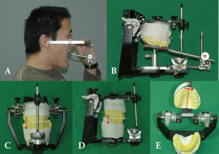 Fig. 9