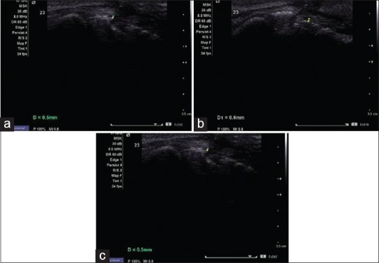 Figure 14