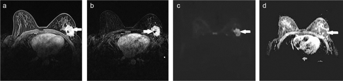 FIG. 4. a–d.