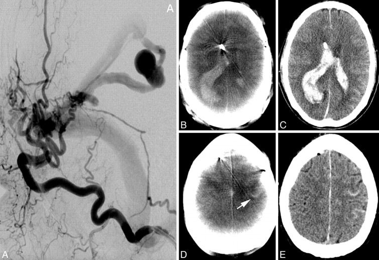 Fig 2.