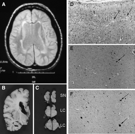 FIG. 1.