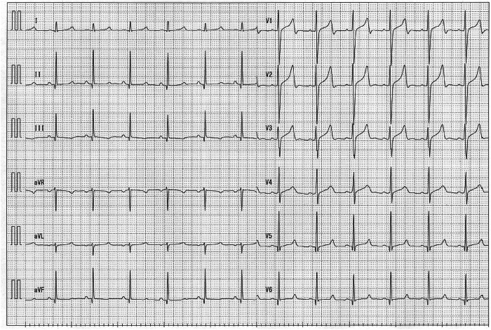 Figure 1