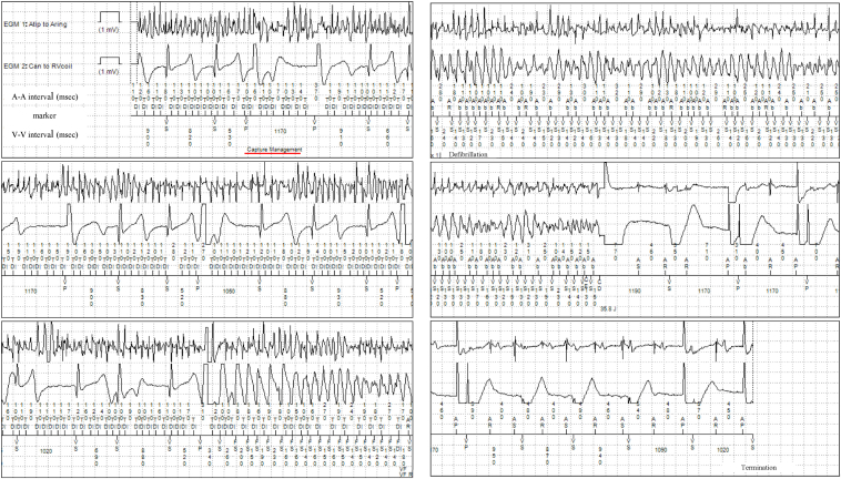 Figure 2