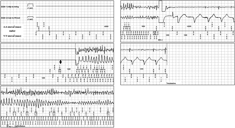 Figure 3