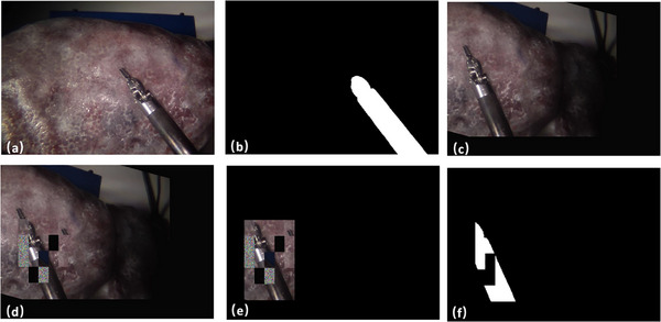 FIGURE 3