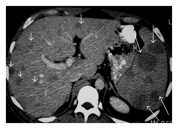 Figure 17