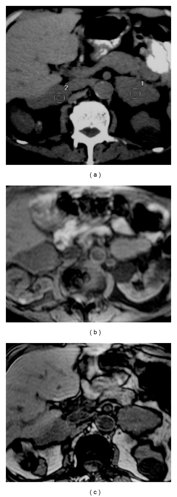 Figure 31